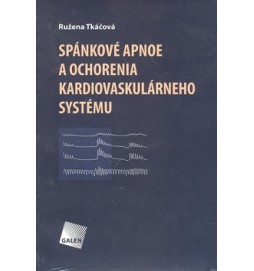 Spánkové apnoe a ochorenia kardiovaskulárneho systému