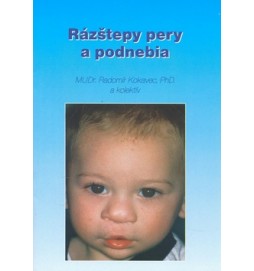 Rázštepy pery a podnebia