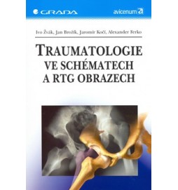 Traumatologie ve schématech a RTG obrazech