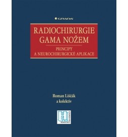 Radiochirurgie gama nožem