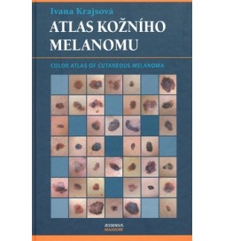 Atlas kožního melanomu