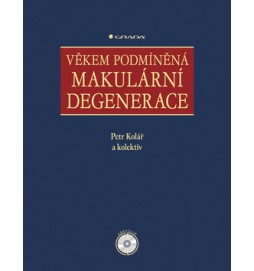 Věkem podmíněná makulární degenerace