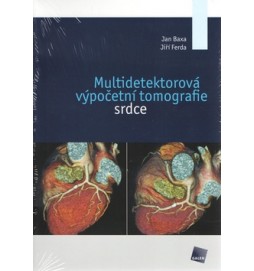 Multidetektorová výpočetní tomografie srdce