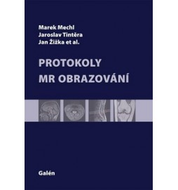 Protokoly v MR zobrazování