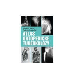 Atlas ortopedické tuberkulózy