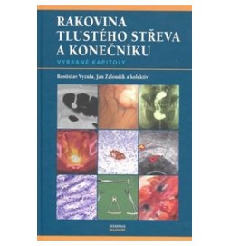 Rakovina tlustého střeva a konečníku - vybrané kapitoly