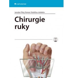 Chirurgie ruky