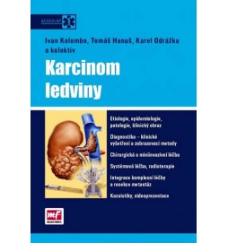 Karcinom ledviny