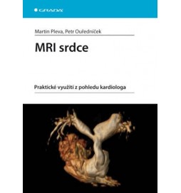 MRI srdce -  praktické využití z pohledu kardiologa