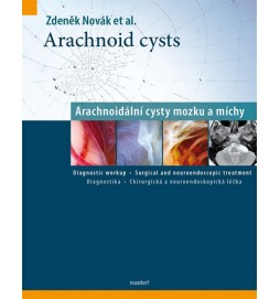 Arachnoid cysts - Arachnoidální cysty mozku a míchy