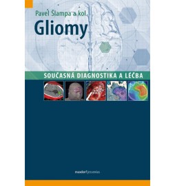 Gliomy - Současná diagnostika a léčba