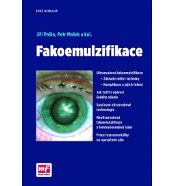 Fakoemulzifikace