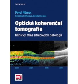 Optická koherenční tomografie - Klinický atlas sítnicových patologií